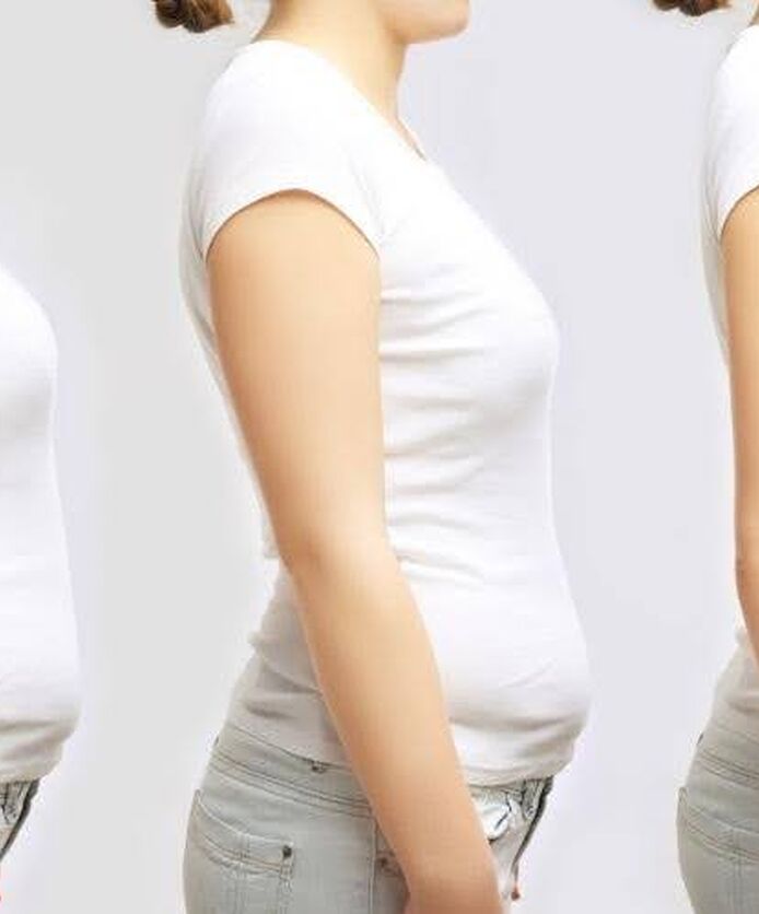Weight loss progression showing body changes that may occur during Mounjaro treatment.