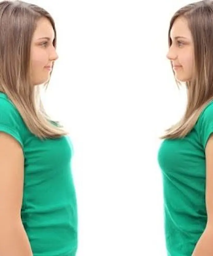 Woman shown before and after weight loss.