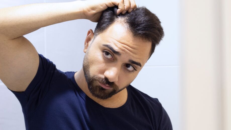 A man checks his hair, looking for signs of baldness.